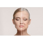 第四代無針線膠原自生